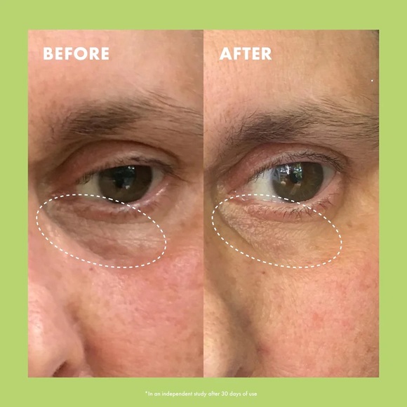 Kopari Niacinamide & Caffeine Eye Bright Cream - Picture 3 of 8